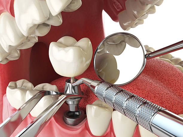 Best Emergency Treatment for Oral Infections in Lawrence, IN